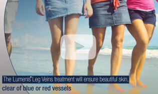 Lumenis Leg Veins Treatment