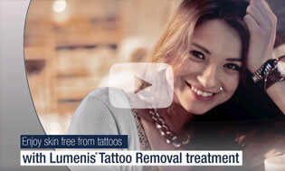 Lumenis Tattoo Removal Treatment
